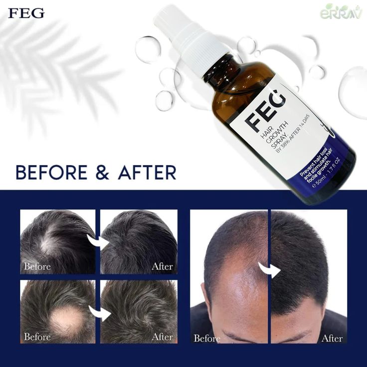 FEG Organic Hair Growth Treatment Oil